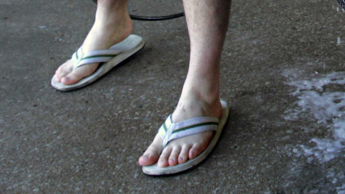 What’s with all the Kansas City guys in shorts and sandals during freezing weather? | Opinion