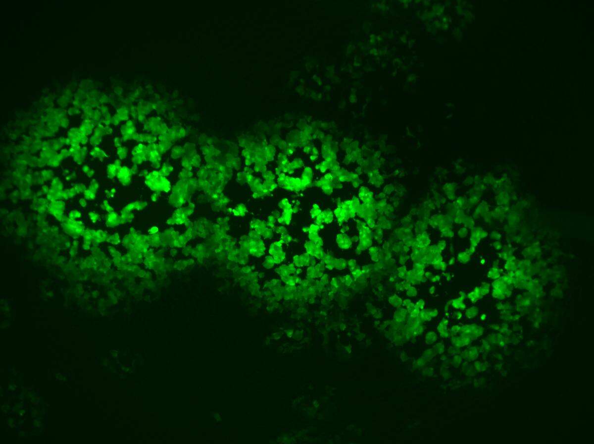 Poxvirus, which produces a green fluorescent protein, can replicate quickly in human cells unless resveratrol, a compound found naturally in many foods, is present, according to a study by researchers at Kansas State University and Centers for Disease Control and Prevention.