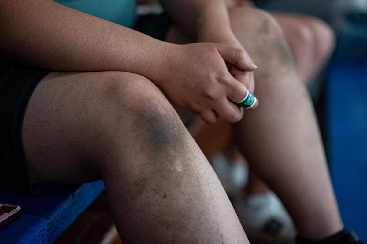 Anna Le of Wichita said her hands and knees were muddied as she crawled through the overturned train to escape the wreckage.