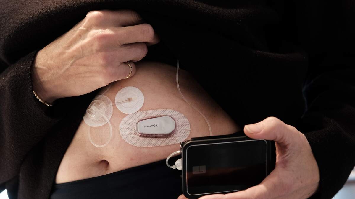 Read-Only Wearable Devices vs Read-Write Systems Explained