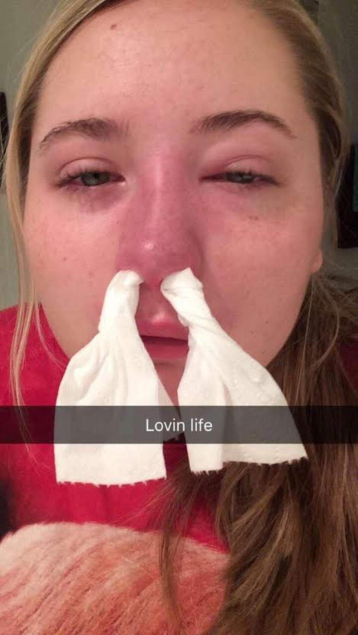 In July 2017, Jordyn Walker, then 14, sent out a selfie just before her mysterious condition became desperate, causing her to bleed from her eyes, nose and mouth and nearly taking her life.