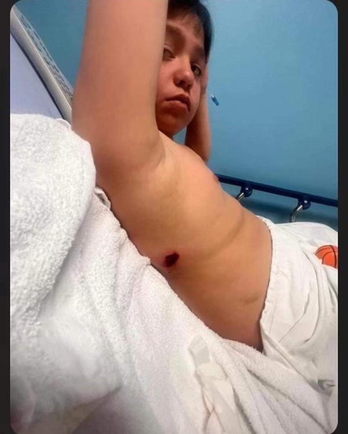 Samuel Arellano showed the bullet wound he suffered at Union Station during the Kansas City Chiefs Super Bowl celebration where 23 people were shot.