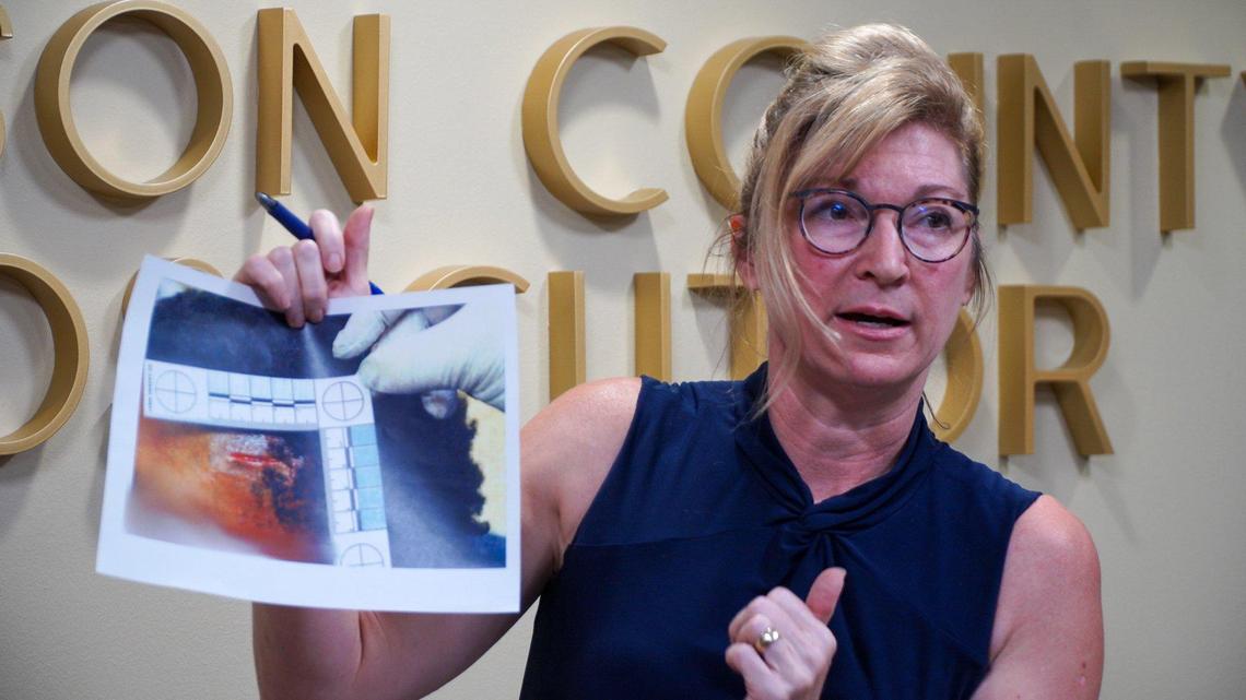 Jackson County Prosecutor Jean Peters Baker holds a photo evidence showing a gashed forehead of a 15-year-old who was allegedly kneeled on by a Kansas City police sergeant last November. A Jackson County grand jury indicted Matthew T. Neal on Friday, Aug. 20, 2020, for third-degree assault of a teenage victim.
