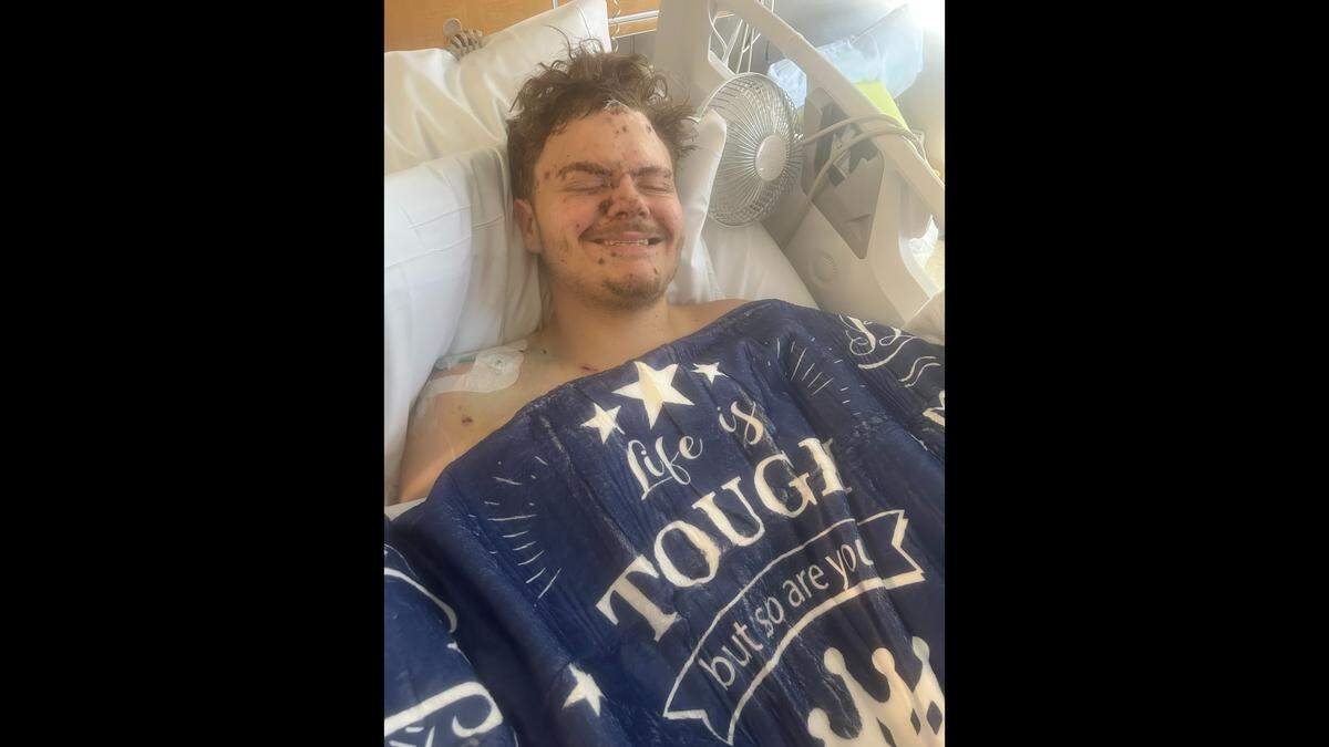 Preston Sloan, of Lawson, Missouri, was critically injured on April 17, 2026 when what he thought was a firework exploded. He ruptured his eardrums and suffered trauma to his hands, including the loss of a thumb. His most severe injuries were to his eyes. Sloan has regained some sight in his left eye, but his right one struggles to heal after nearly three weeks.