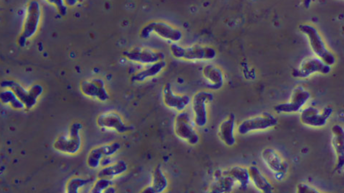 SC folks won’t get brain-eating amoeba infections if they follow these expert tips