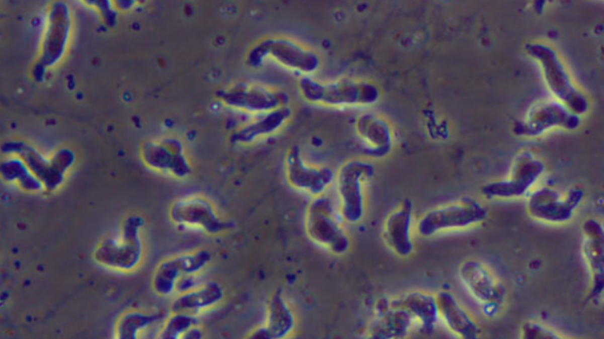 An Arkansas resident died after being infected with the brain-eating amoeba called Naegleria fowleri, officials say.