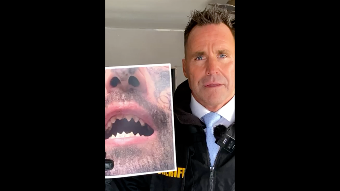 Police in Michigan say a man with filed teeth kidnapped a woman, holding her captive for weeks.