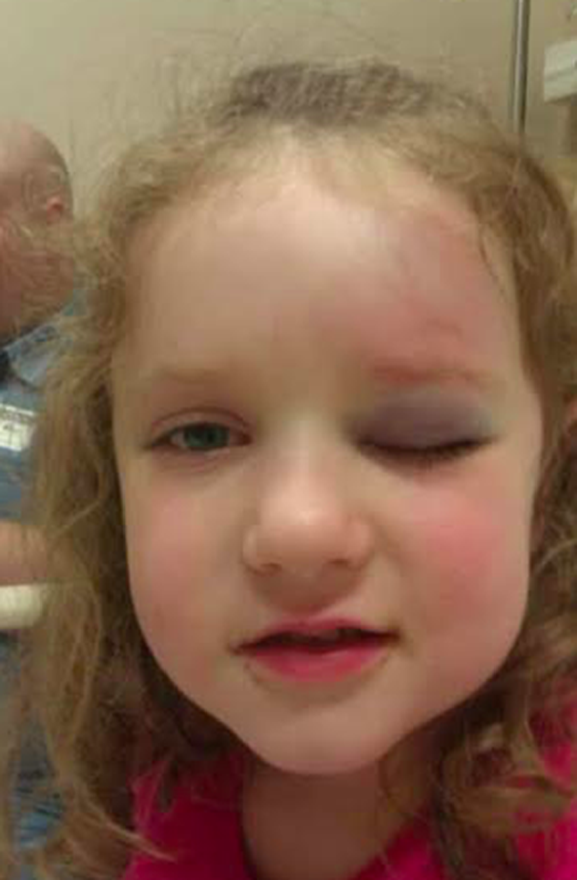 Alexis Hoskey, who was 4 years old when she was hit by a foul ball while attending a Kansas City Royals game in 2011, is advocating for increased safety measures at MLB ballparks.