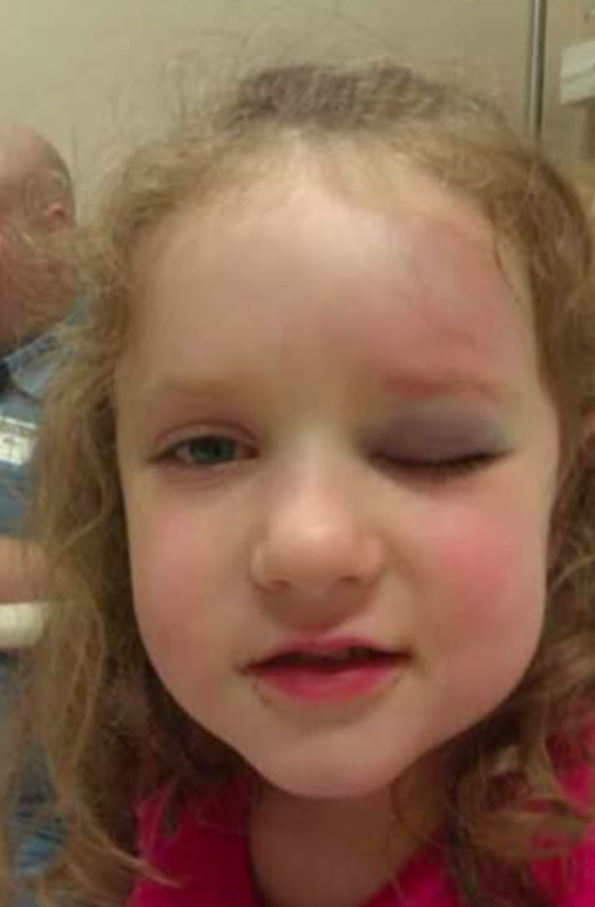 Alexis Hoskey, who was 4 years old when she was hit by a foul ball while attending a Kansas City Royals game in 2011, is advocating for increased safety measures at MLB ballparks.