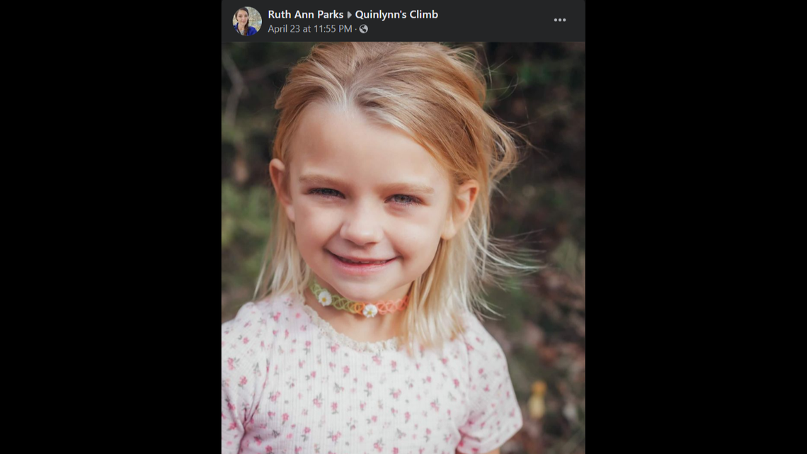 A 7-year-old girl is hospitalized and in a coma after she was struck by a falling tree limb in Kansas winds, family says.