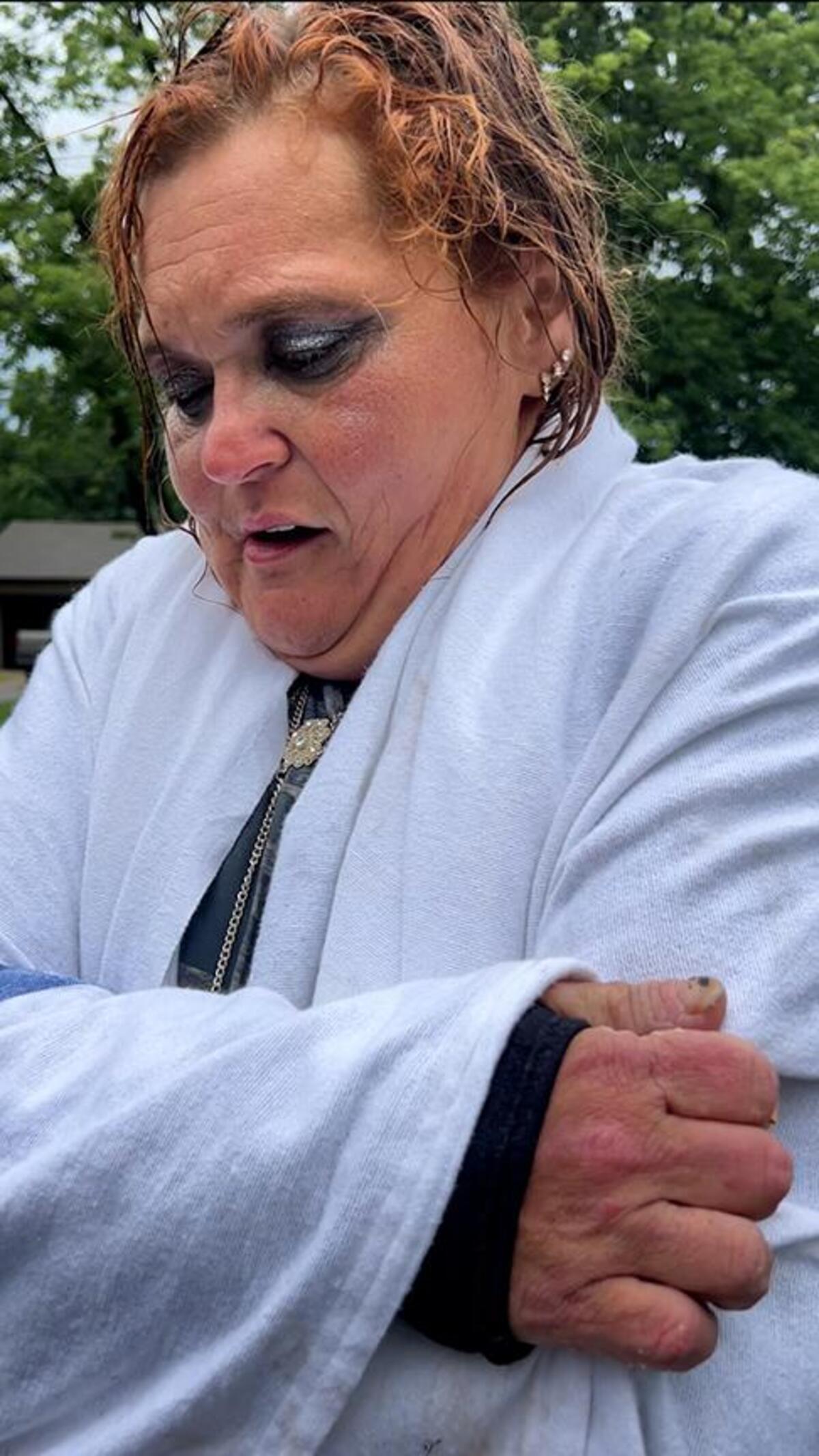 A woman who said she was camping near Indian Creek, near 103rd Street and Wornall Road, was rescued by the Kansas City Fire Department during a flash flood on Monday, July 21, 2025, in Kansas City. The woman, who declined to give her name, was clinging to a tree when she was rescued.