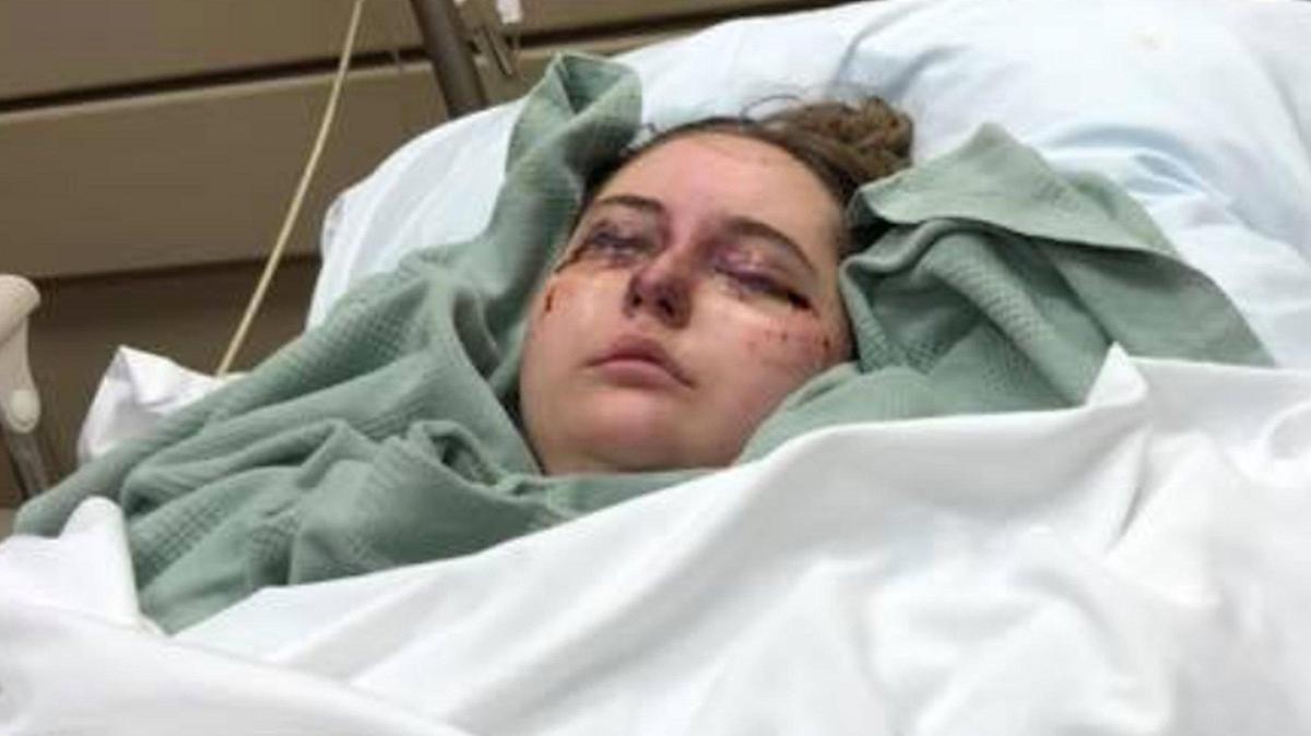 Bleeding from her eyes, Missouri teen’s illness mystifies doctors and captivates world