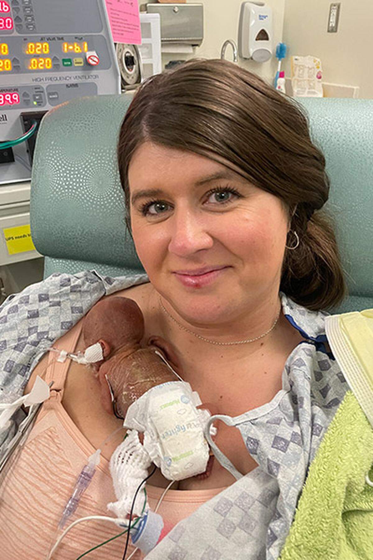 Nash Keen was born on July 5, 2024, 133 days before his scheduled due date.