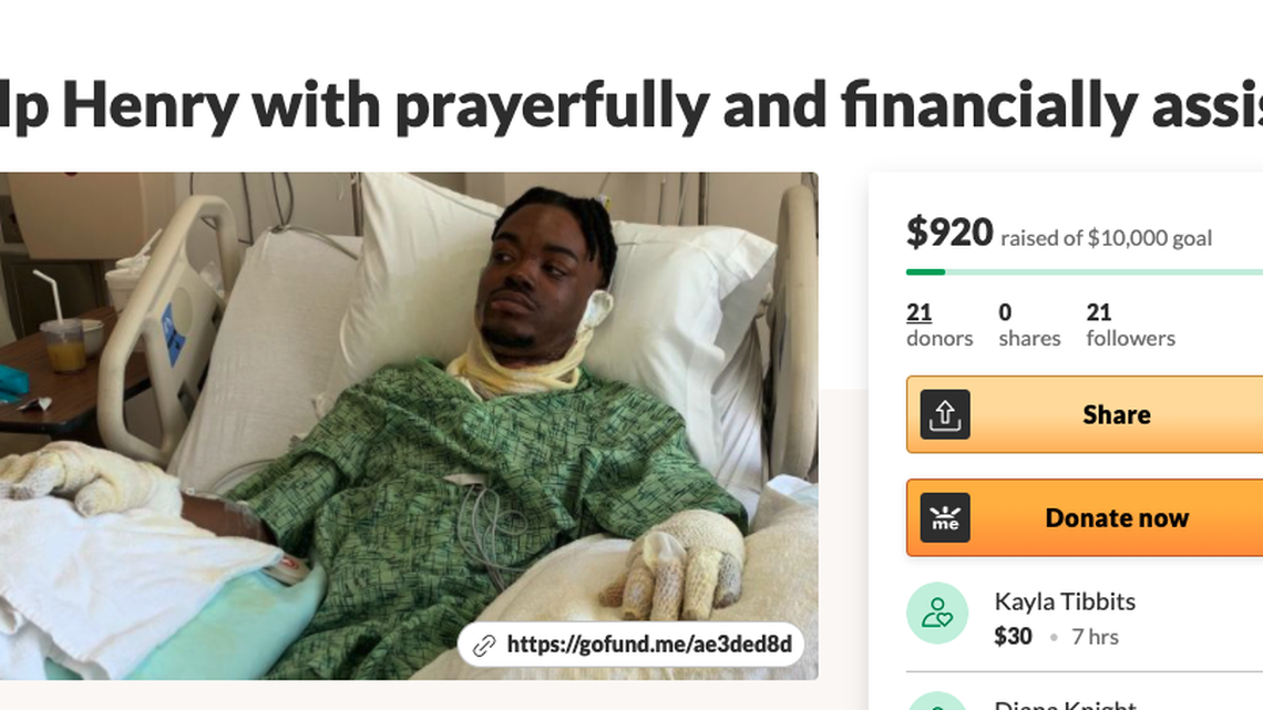 Henry Williams was set on fire in his sleep by his wife, according to Wisconsin police.