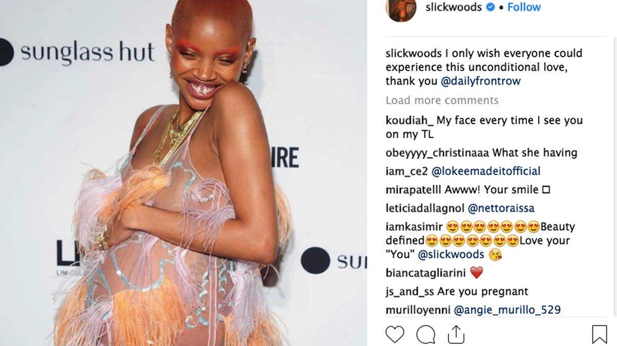 Model Slick Woods says she was in labor while she walked the runway in Rihanna’s Savage X Fenty New York Fashion Week show. Woods said on Instagram she gave birth to a boy after 14 hours of labor.