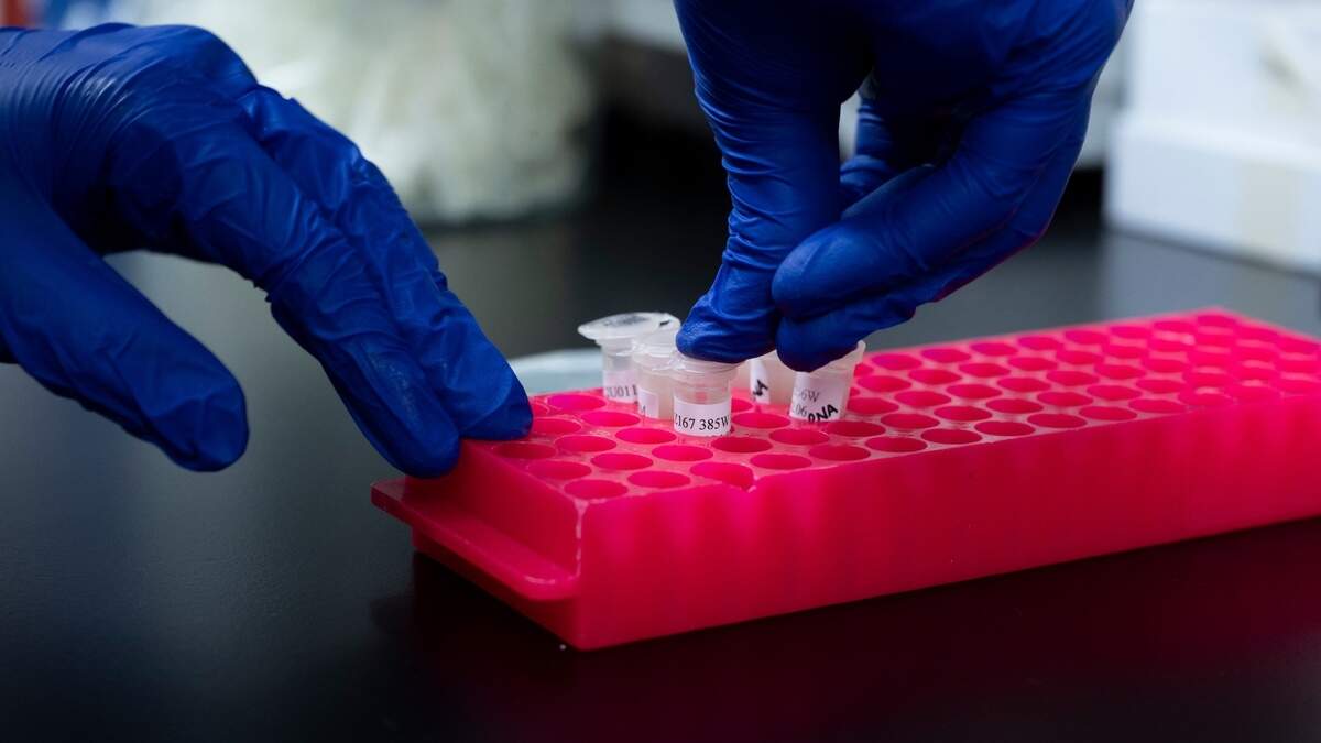 Is Apolipoprotein B testing a stronger alternative to LDL tests