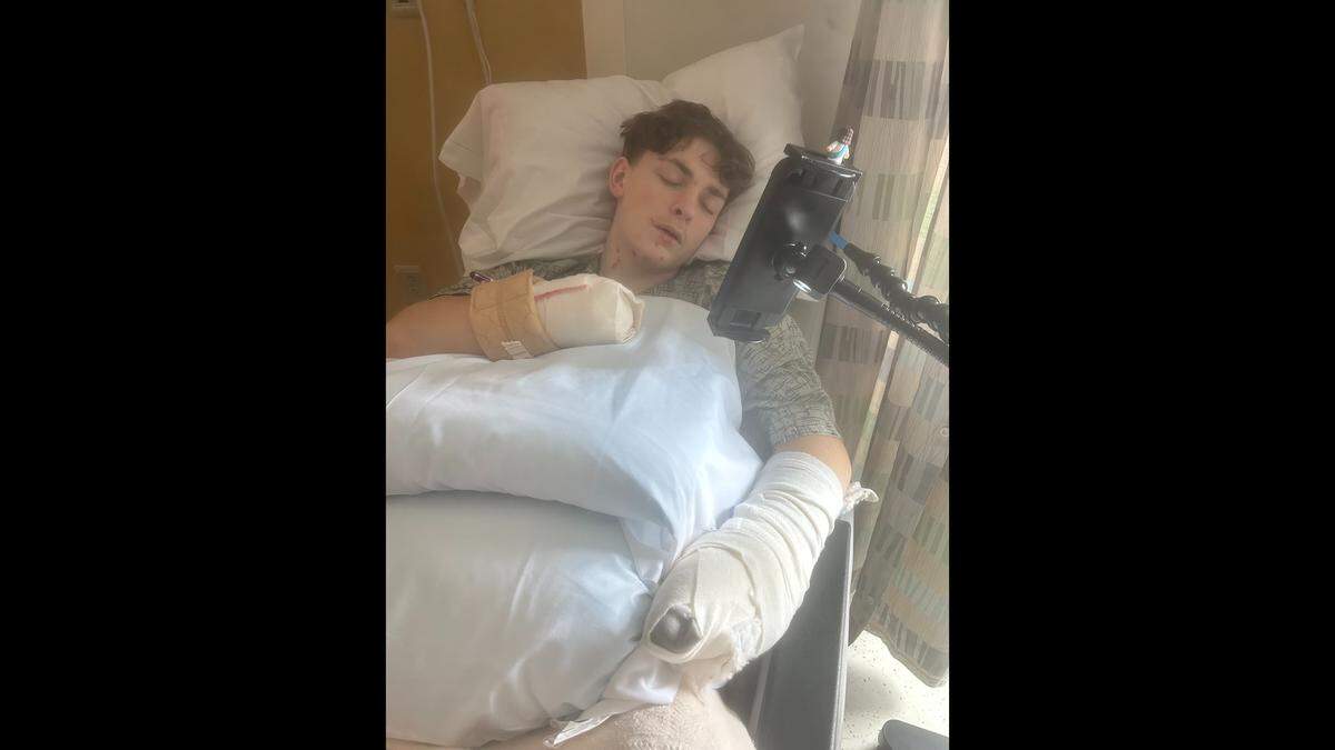 Carter Grabowski, of Excelsior Springs, was critically injured on April 17, 2026 when what he thought was a firework exploded in his hands. He ruptured his eardrums in the blast, suffered shrapnel injuries and lost both of his hands.