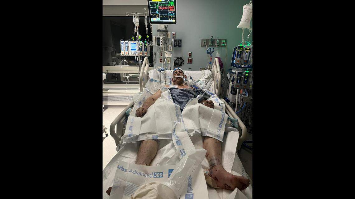 Chris Culbertson died after he was attacked by a pack of dogs.