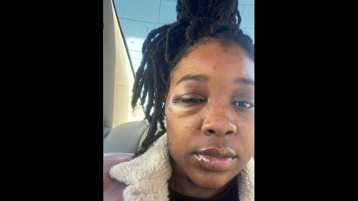 Daysheion Renee Ponds says Kansas City police used excessive force when they arrested her Jan. 28 in the Power & Light District.