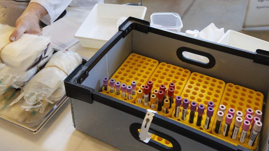 How accurate are Alzheimer’s blood tests? Experts explain what the results really mean