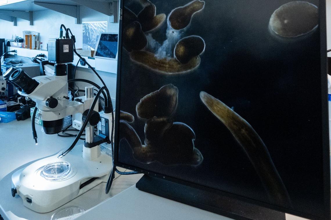 A microscope enlarges planarians, flatworms that split themselves into two and create separate organisms, in a lab inside the Stowers Institute for Medical Research in Kansas City.