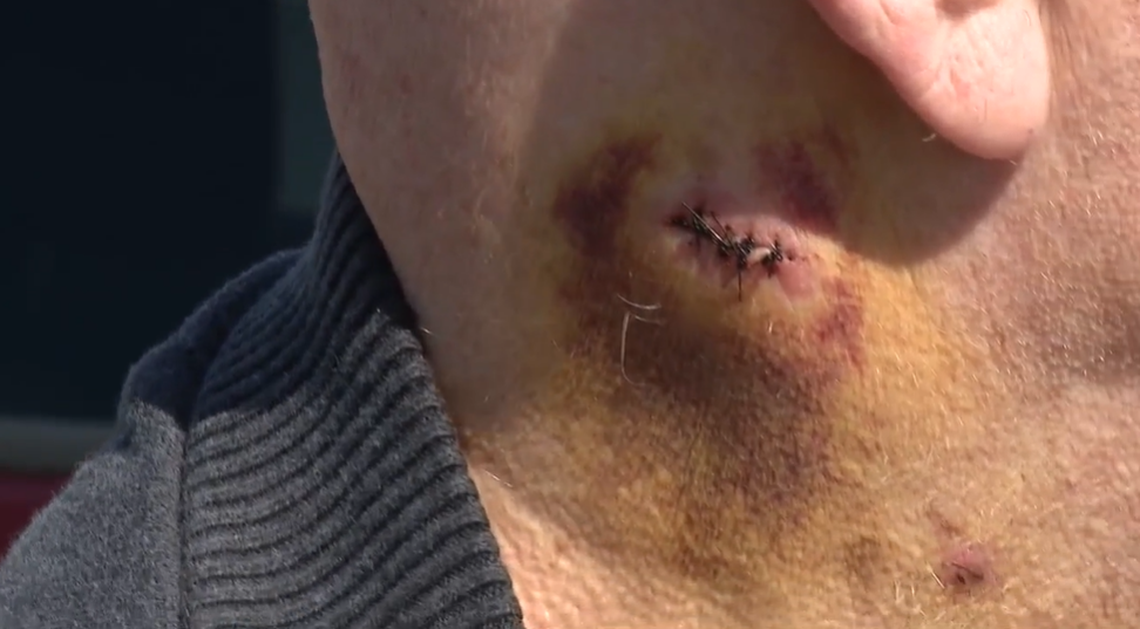 The passenger stabbed Evans in the neck with a knife, police said.