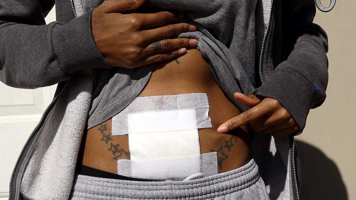 Akacia Moore of south Kansas City was shot in her home while getting up to get a napkin. The bullet remains lodged in her abdomen. The Jackson County prosecutor’s office has a new program called “Caring for Crime Survivors” which helps victims of shootings and other crimes.