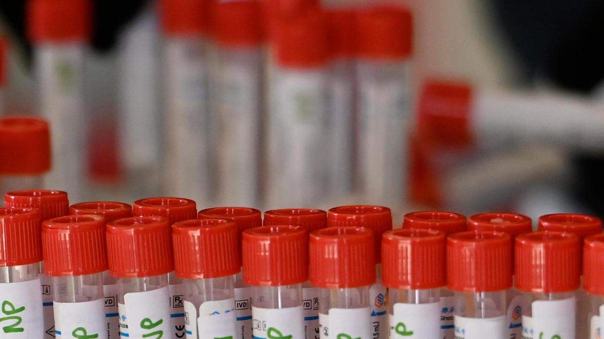 Test samples collected during a drive-thru COVID-19 testing clinic await testing on Wednesday, January 5, 2022, at 616 N.E. Douglas St., in Lee’s Summit. The clinic, which requires an appointment, is run by the Jackson County Health Department and offered 300 appointments on Wednesday.