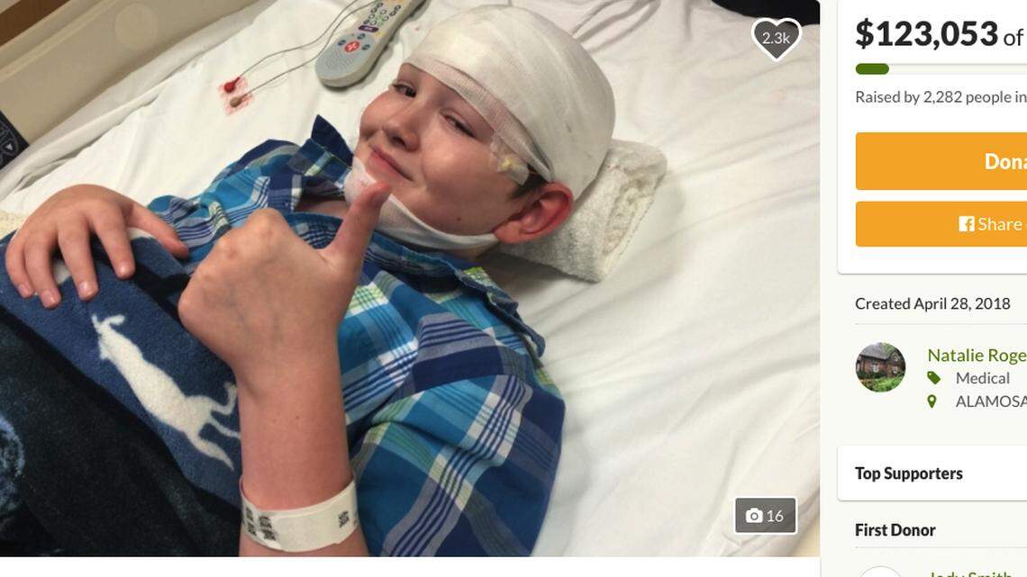 Jaiden Rogers, 12, of Alamosa, Colorado, has a rare skin condition that is turning his skin hard like stone. Only a few dozen people around the world have ever been diagnosed with the condition, doctors say.