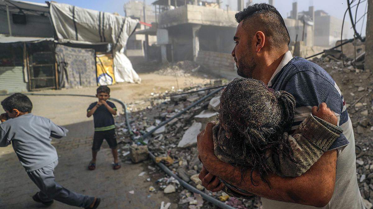 A man holds an injured child for help after an Israeli airstrike in the Jabalia refugee camp in the northern Gaza Strip on May 21.