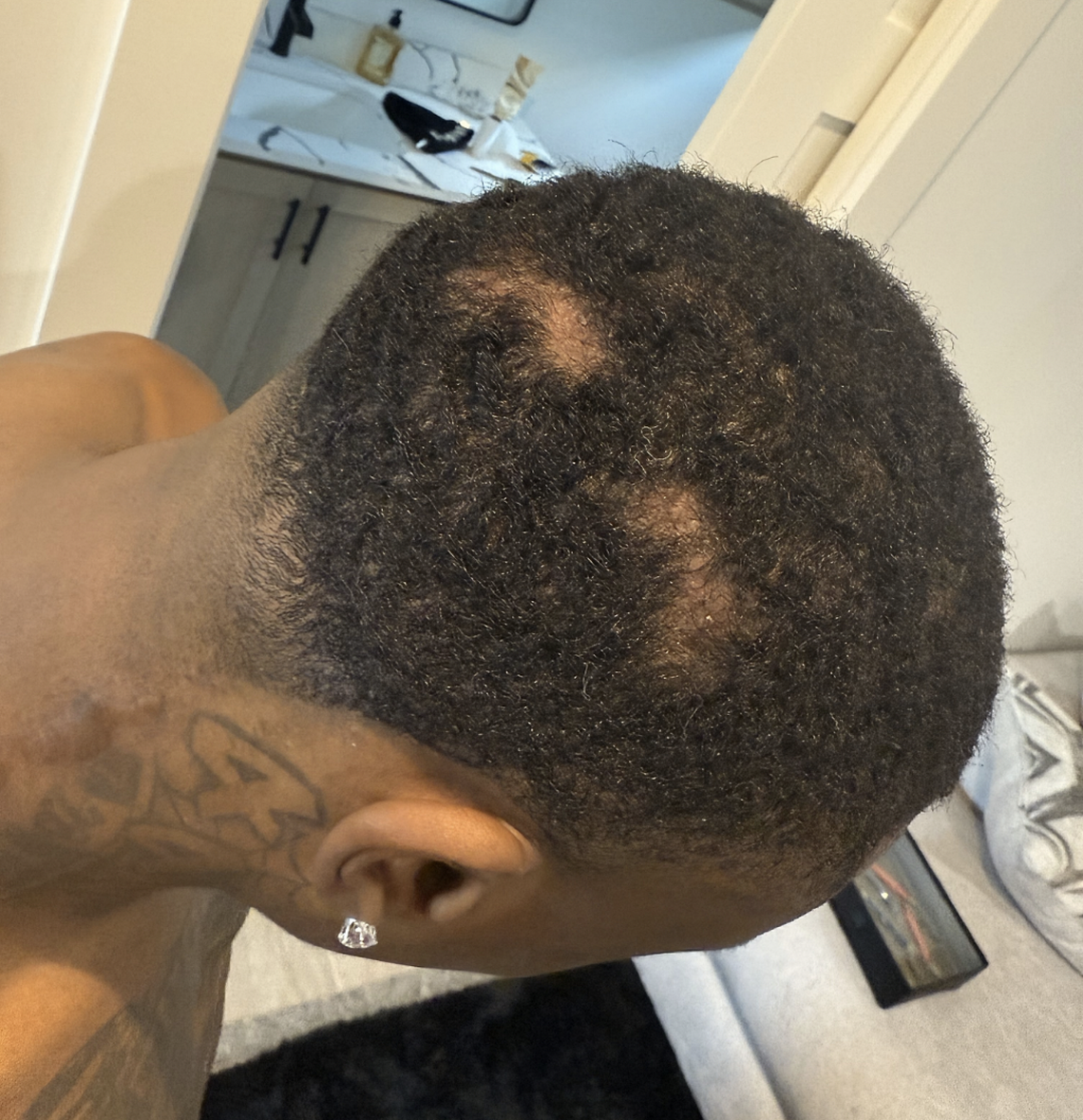 A photograph of the back of Kansas City Chiefs receiver Xavier Worthy’s head is included in his petition filed Monday, March 24, 2025.
