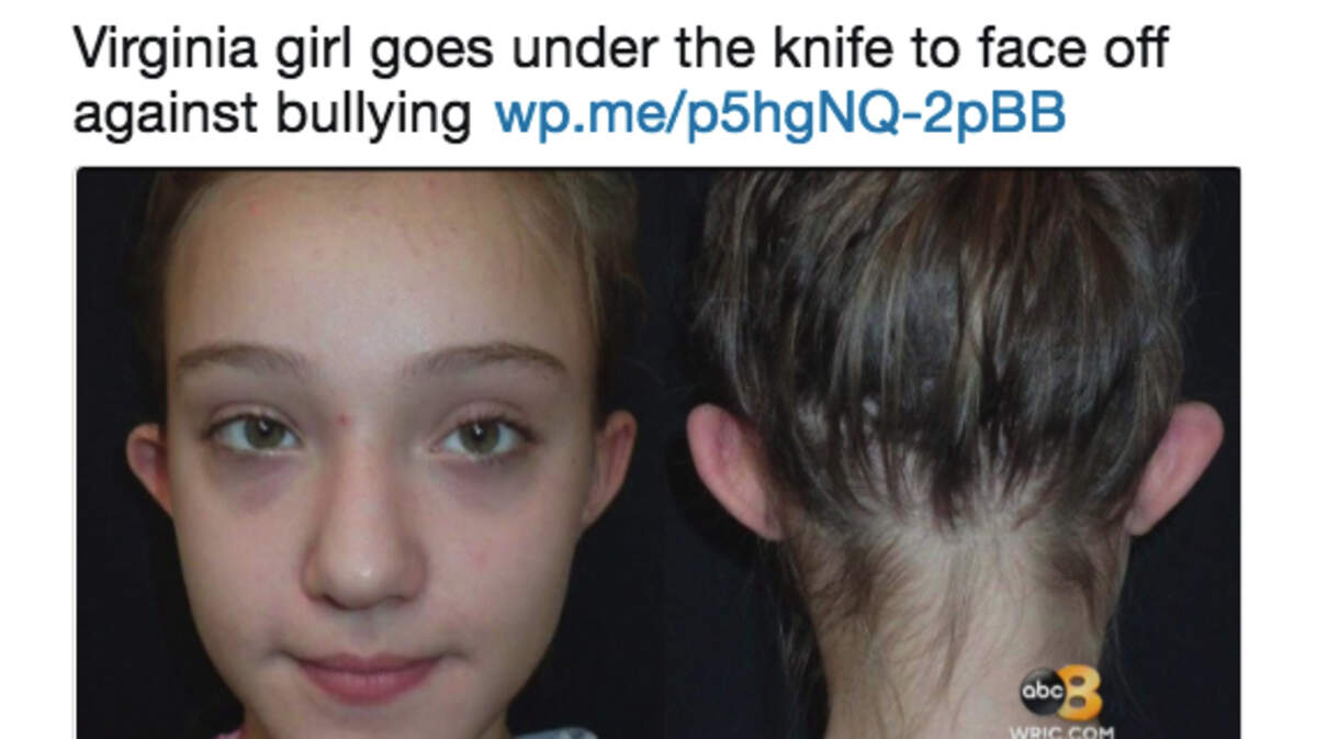 Bella Harrington, 11, had plastic surgery to correct the "elf ears" that made her a target of bullies. She and her mother are happy with the results.