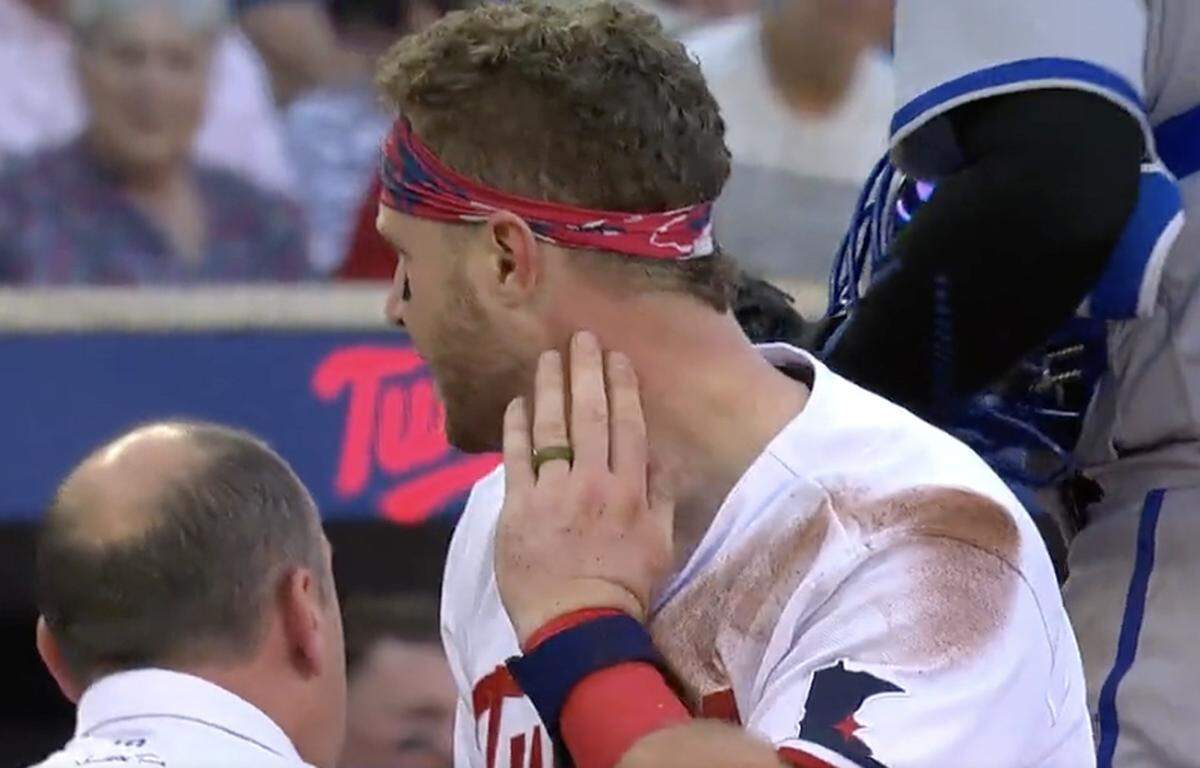 Ryan Jeffers had a big red mark on his neck.