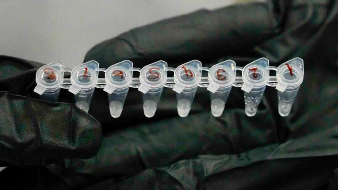 6 people tested after exposure to Missouri bird flu patient. What we do & don’t know