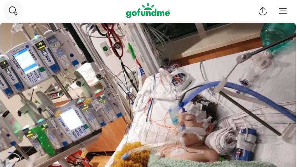 A 1-year-old boy nearly drowned after falling into a backyard pool, Indiana deputies said. Now, the toddler is fighting for his life. 