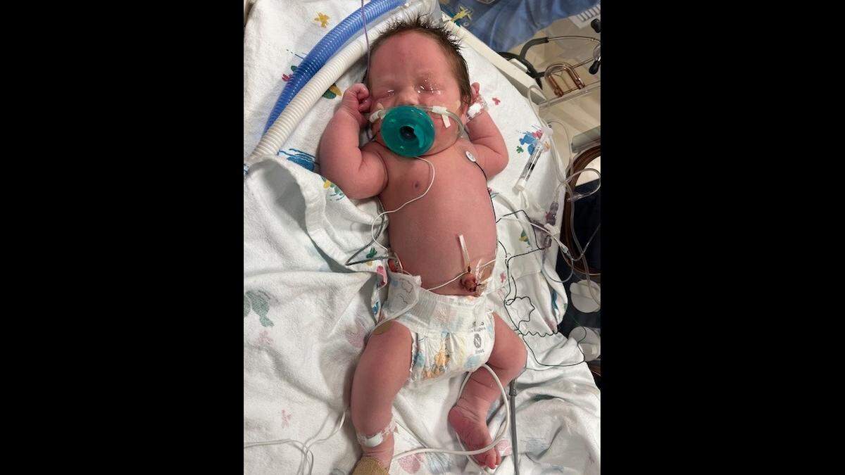 Abbott was born in late June 2023. His biological mother, who was homeless, told family and friends she didn’t know how she would care for him. Immediately after his birth, she reached out to Kayleigh Wasmer and asked if she and her husband would adopt him. She and Kayleigh were from the same small town.