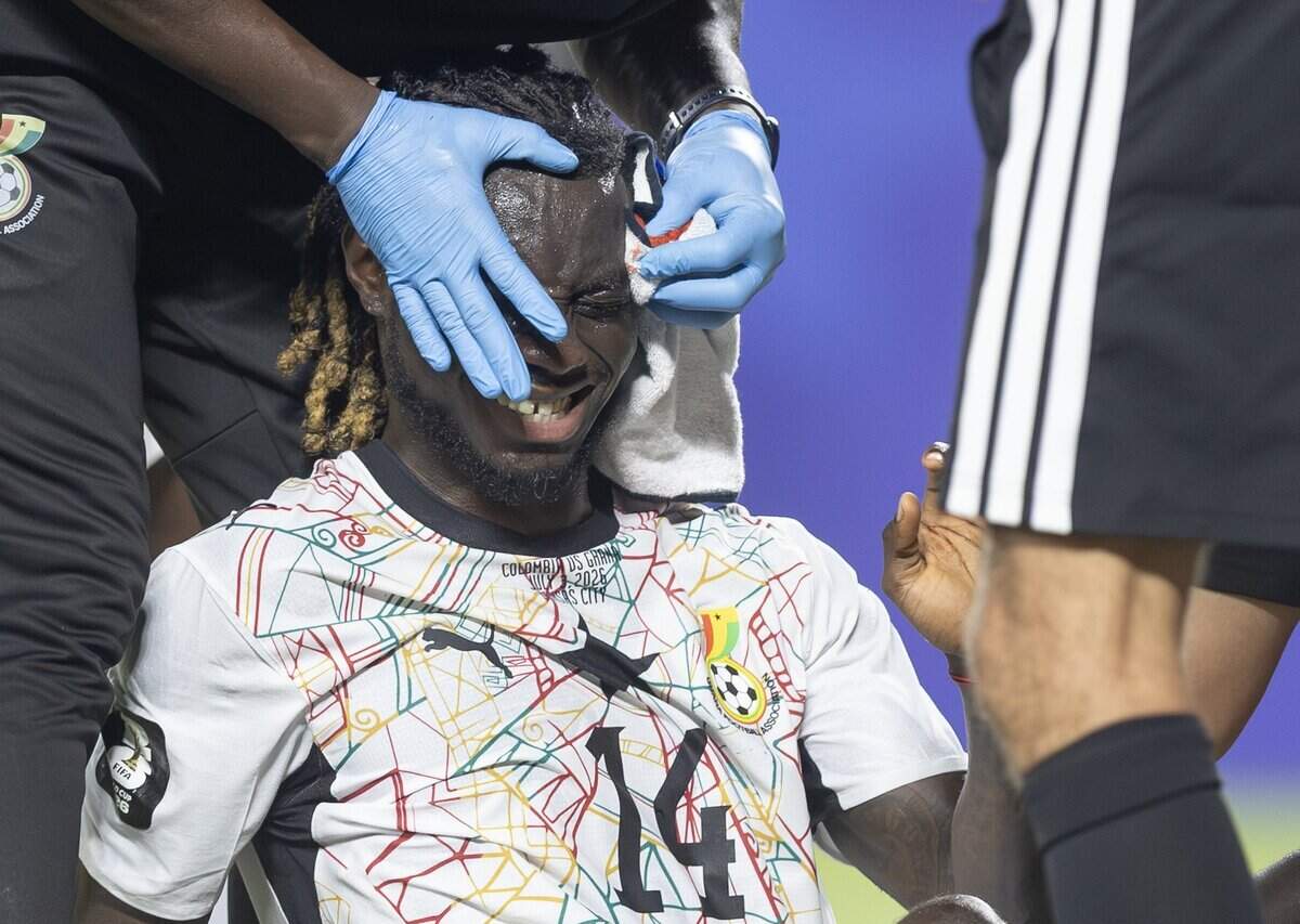 Ghana defender Gideon Mensah (14) is treated for an injury late in the game against Colombia during a FIFA World Cup knockout stage soccer match at Kansas City (Arrowhead) Stadium in Kansas City on Friday, July 3, 2026.