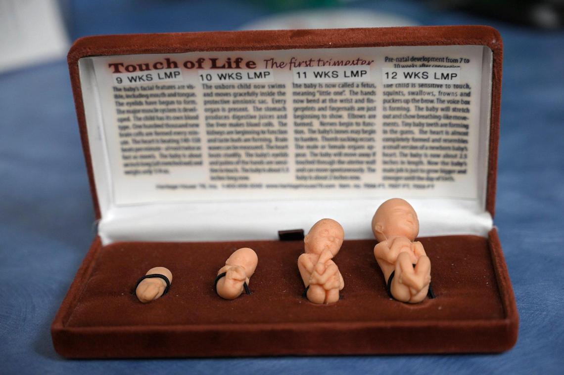 “Touch of Life” models that show development during the first trimester are used at Advice & Aid Pregnancy Centers in Overland Park. Sonograms are also used in trying to convince a woman to carry to full term instead of getting an abortion.