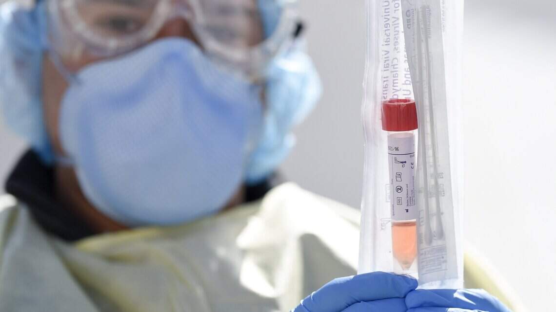 26 more Missourians die from COVID-19, more than 7,300 cases confirmed in the state