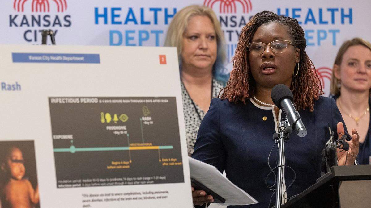 Marvia Jones, Director of Health at the Kansas City Health Department, answers questions during a press conference to discuss Kansas City’s measles preparedness on April 29, 2025, at the Kansas City Health Department.