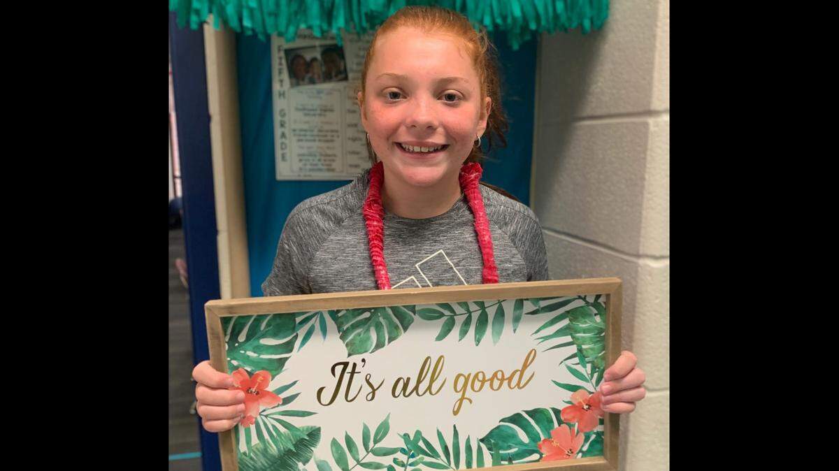 Brinely Hutson, who plays for the Mission United U13 girls soccer team, was recently hospitalized with a life-threatening and rare bacterial infection after a kick to the shin. She had to have the leg amputated below her knee.