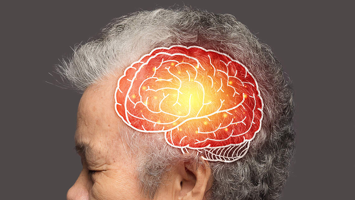 Pollster’s misleading questions undermine accuracy of Alzheimer’s research survey | Opinion