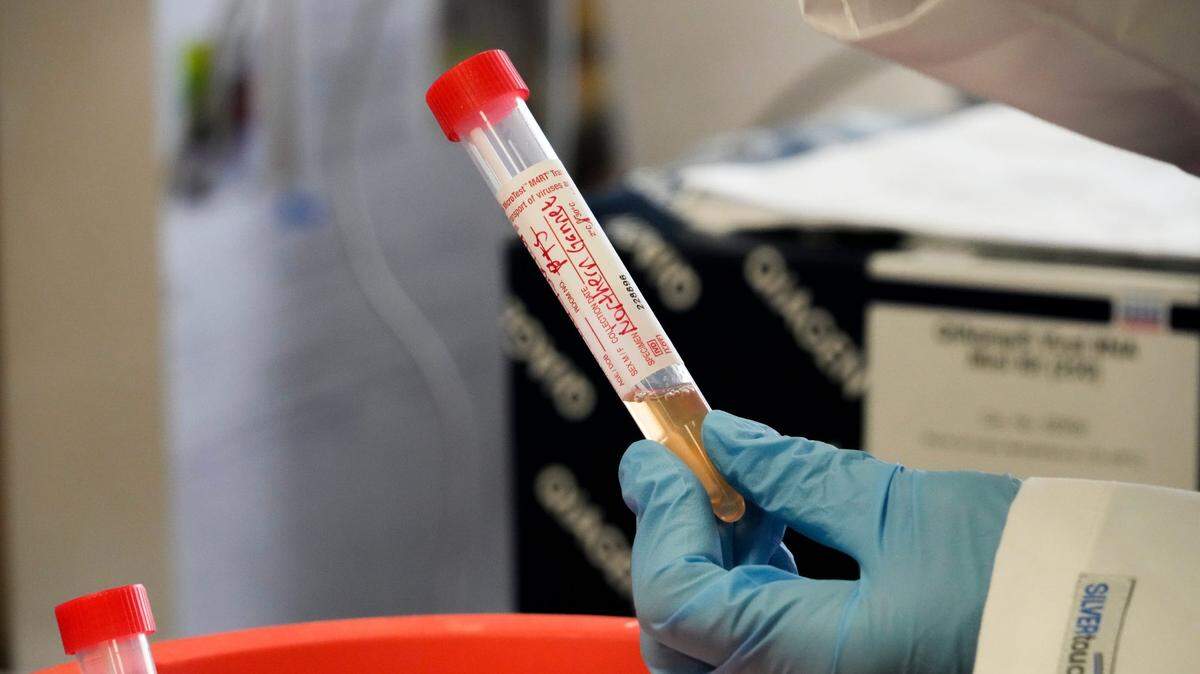 Bird droppings undergo testing in 2022 for the avian flu.