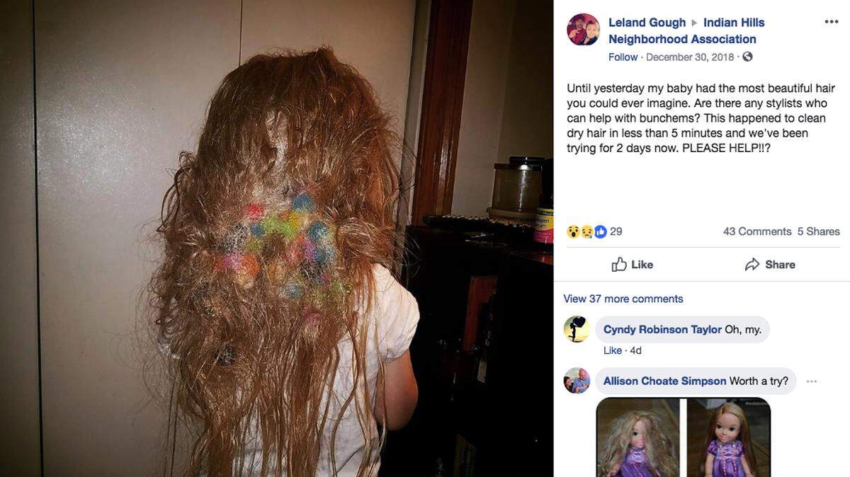 Jasmine Nikunen panicked when someone dumped a bucket of Bunchems on her 5-year-old daughter’s head. More than 50 of the little toy balls turned the little girl’s hair into a rat’s nest of a mess. (Facebook)