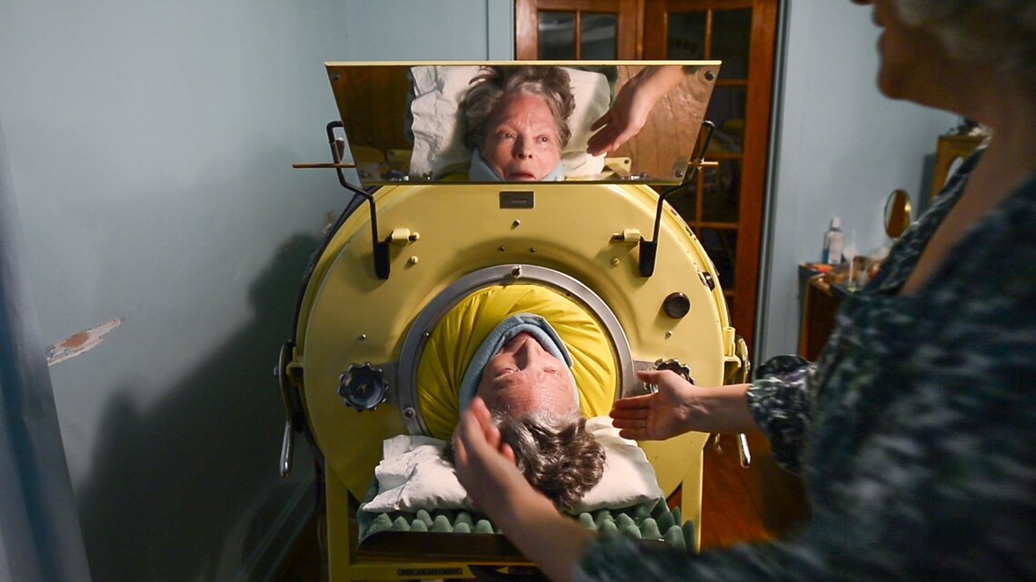 Missouri polio survivor one of last iron lung users in U.S. | Kansas ...