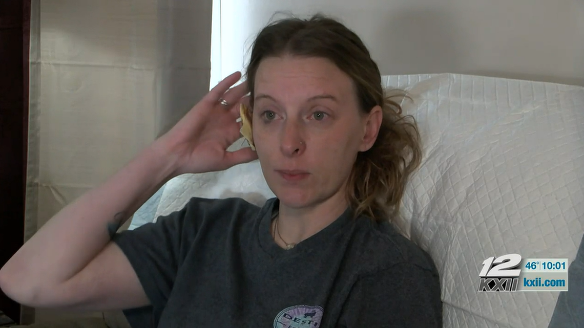 Brittany Parker said a monkey ripped her ear in an attack outside her home, according to KXII.