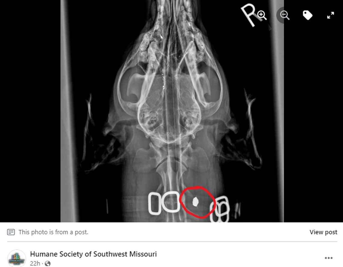 An X-ray revealed a bullet it Benson’s neck.