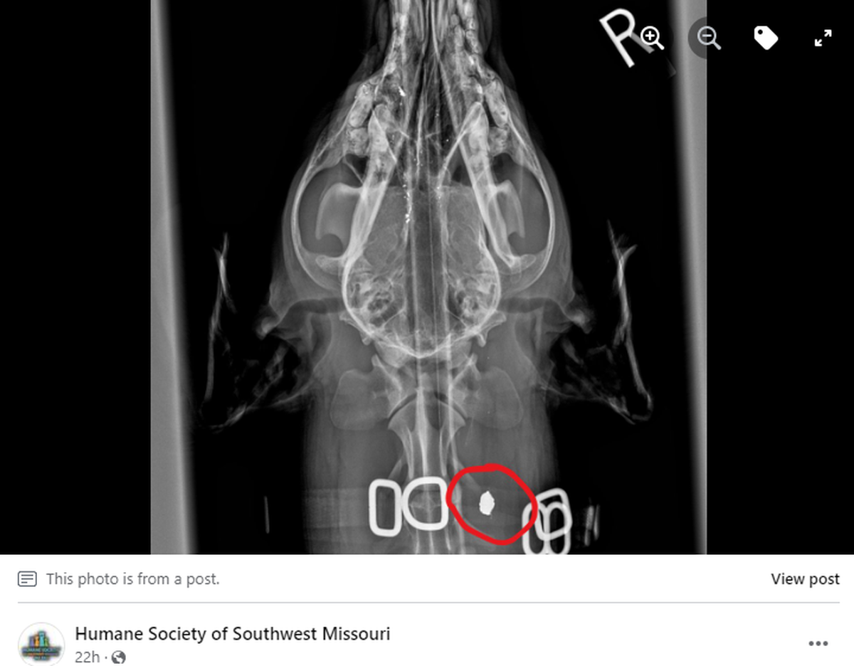 An X-ray revealed a bullet it Benson’s neck.