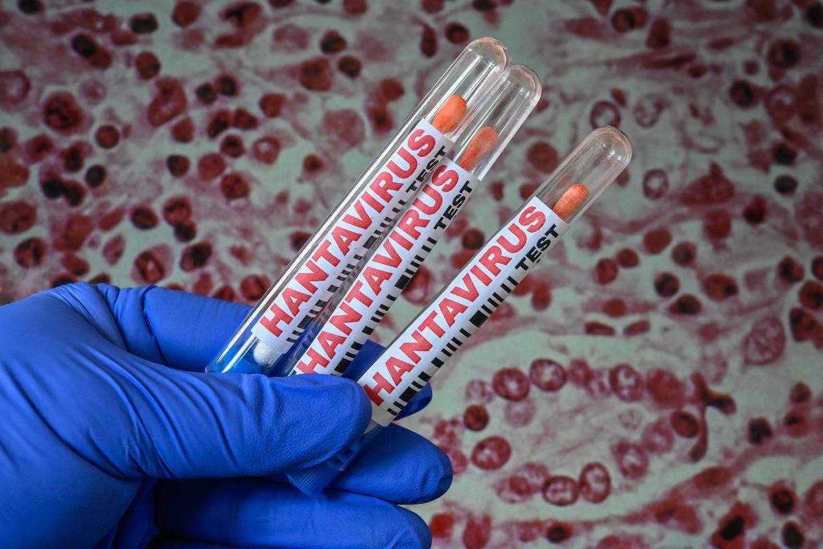 A photo illustration shows the concept of testing for hantavirus using a microscopic image released by the US Centers for Disease Control and Prevention.