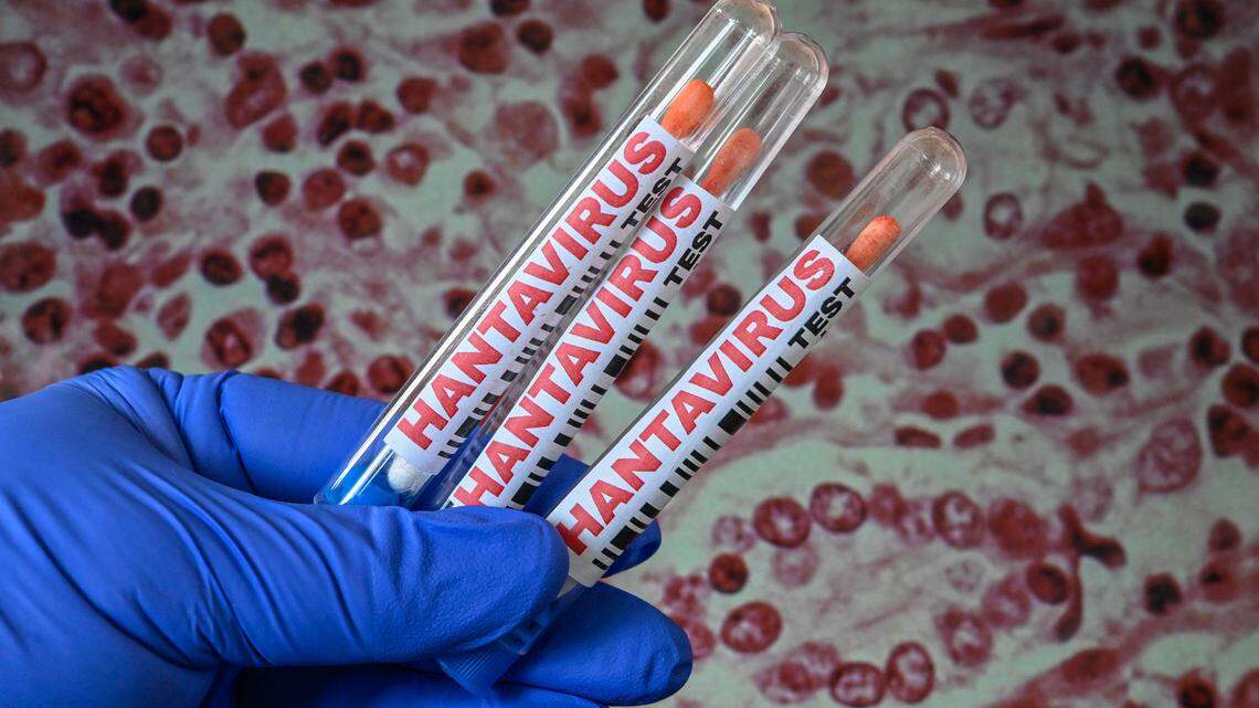 3 Kansans are being monitored for hantavirus. Here’s what we know
